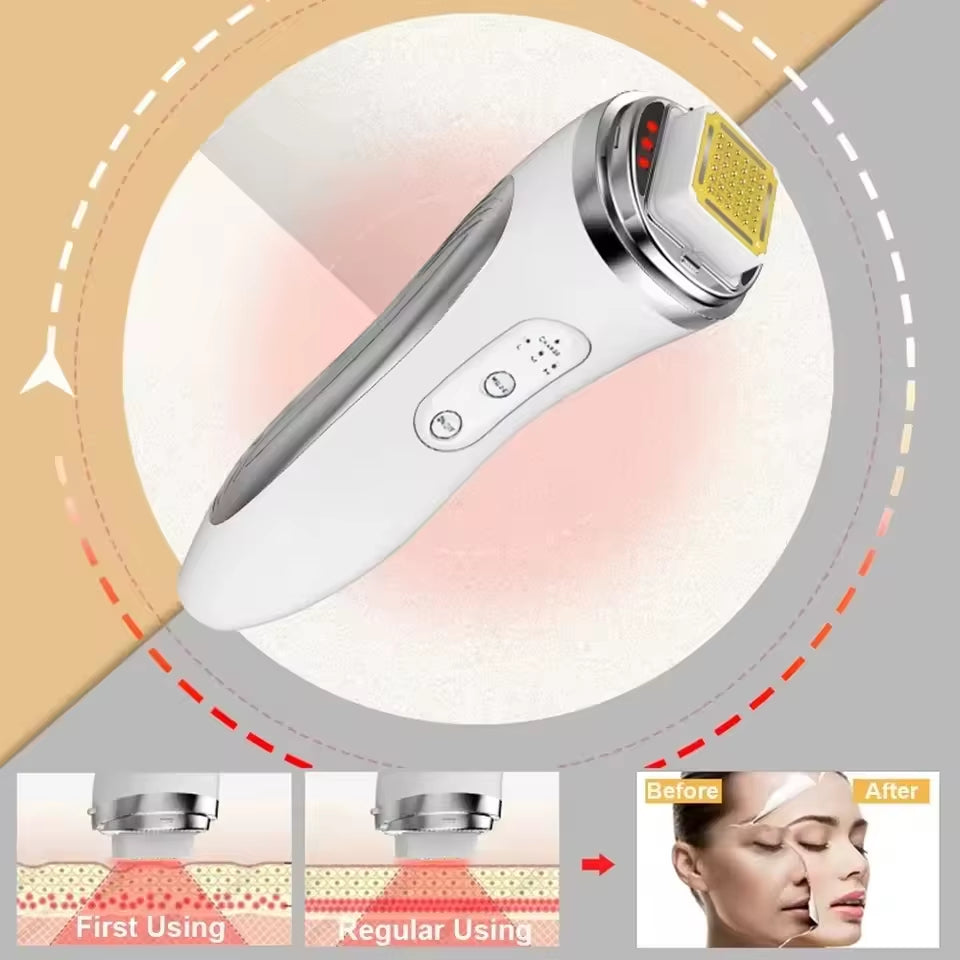 RF Radio Frequency Face Lifting Device Dot Matrix Beauty